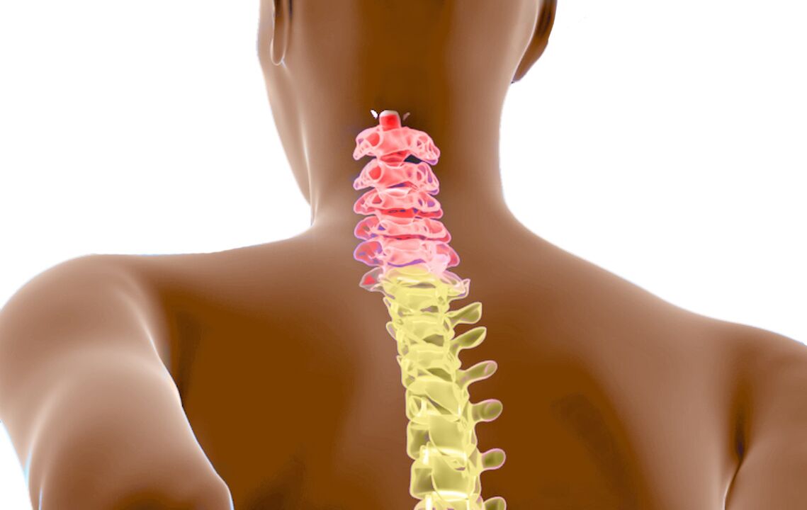 osteochondrosis ng cervical spine