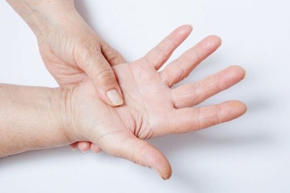 Ang pamamanhid ng kamay ay isa sa mga sintomas ng lumbar osteochondrosis