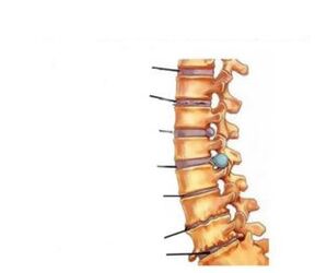 Mga sintomas ng osteochondrosis