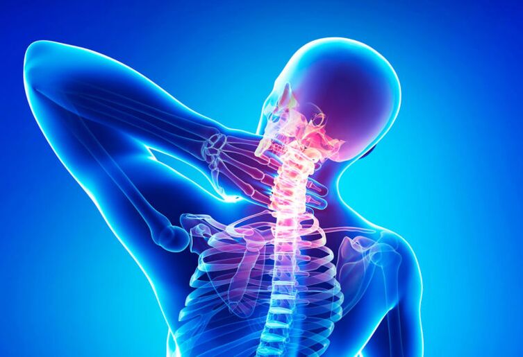 Osteochondrosis ng cervical spine