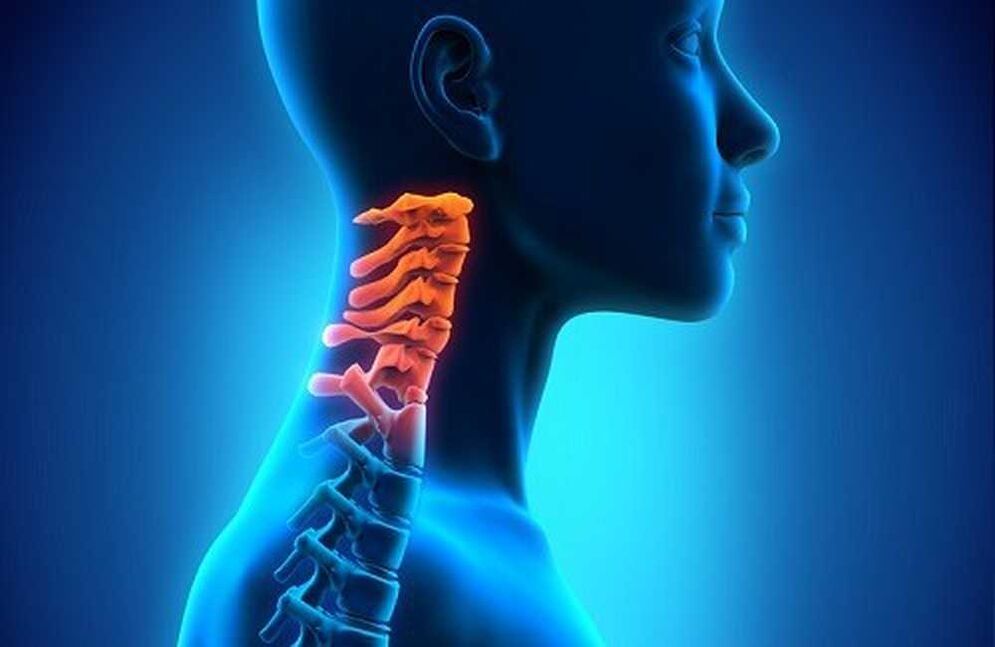 sakit sa cervical spine