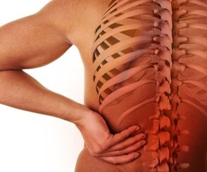 sakit sa likod na may lumbar osteochondrosis