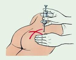 iniksyon para sa paggamot ng osteochondrosis