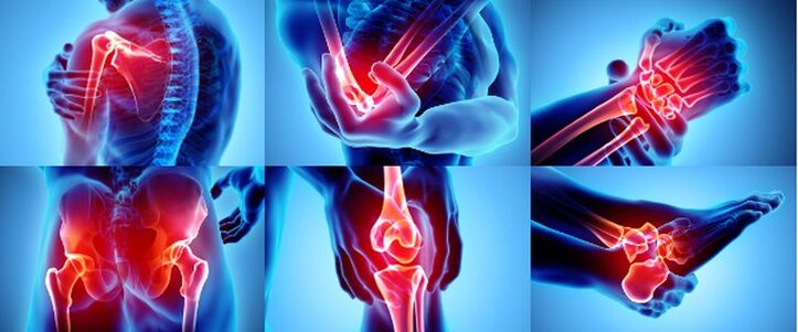 Inflamed joints